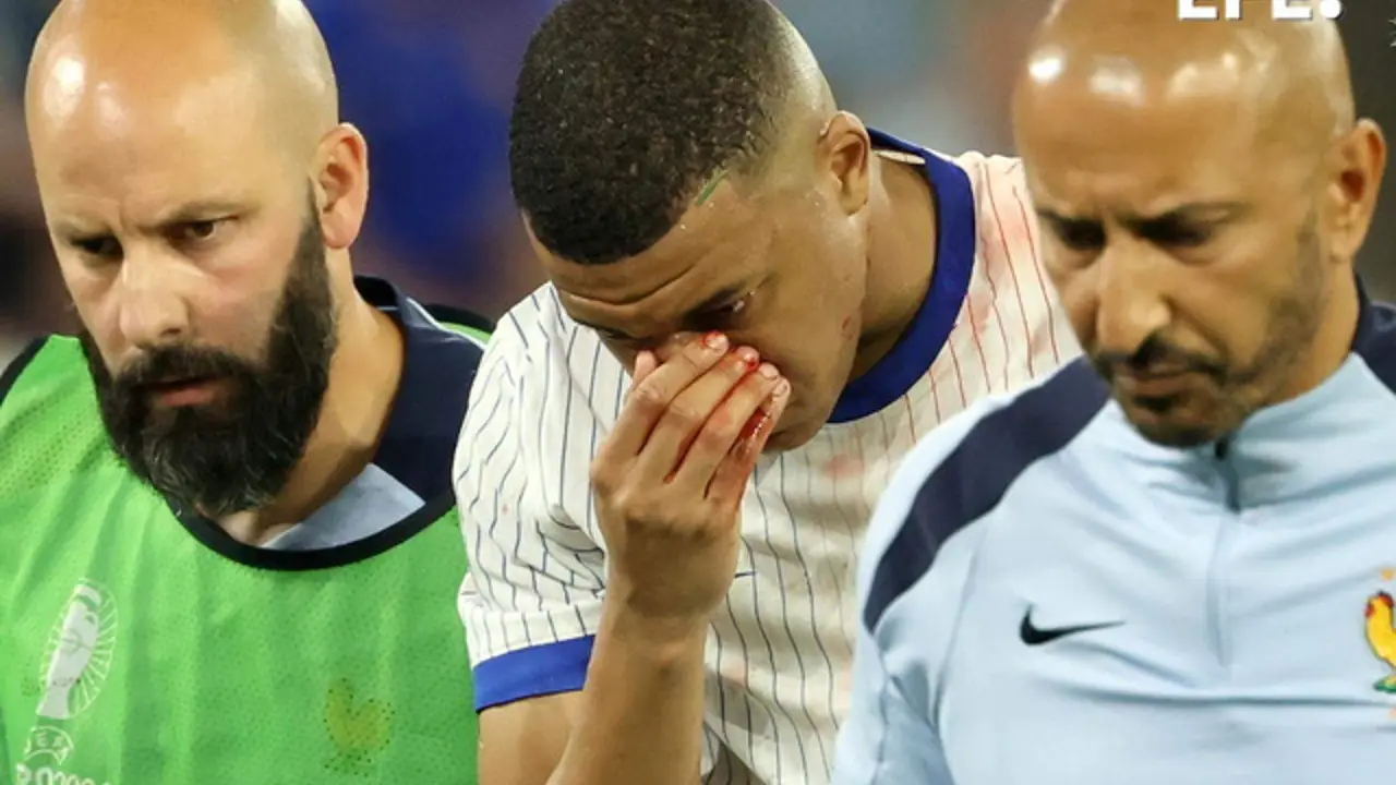 El franc&eacute;s Kylian Mbapp&eacute; sufre fractura de nariz, como consecuencia del golpe sufrido en un choque fortuito con Danso en el partido que enfrent&oacute; a Austria contra Francia (0-1) en el debut de ambas selecciones en el grupo D de la Eurocopa. EFE/EPA/FRIEDEMANN VOGEL