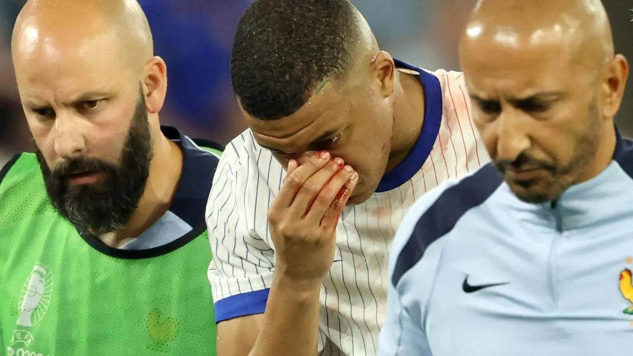 Kylian Mbappe de Francia sale con la nariz rota en el partido del grupo D de la Eurocopa 2024 entre Austria y Francia, en Dusseldorf (Alemania) EFE/EPA/FRIEDEMANN VOGEL